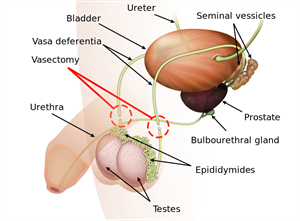 800px-Vasectomy_diagram-en.svg.png