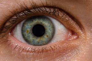 Human_eye_with_blood_vessels.jpg